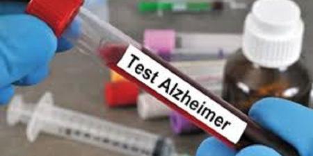الغذاء والدواء الأميركية تعتمد أول اختبار دم لتشخيص الزهايمر