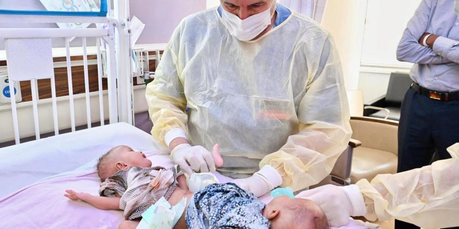 الربيعة يطمئن على صحة التوأم الملتصق الصومالي "رحمة ورملا"