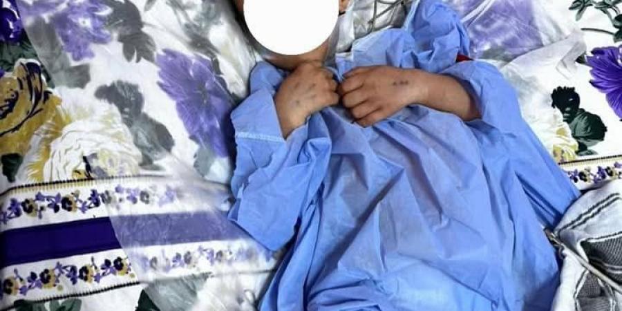 إنقاذ حياة طفل عقب تعرضه لحادث مروع بمستشفيات جامعة سوهاج