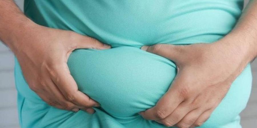 دراسة تكشف الصلة المباشرة بين دهون البطن بالصدفية